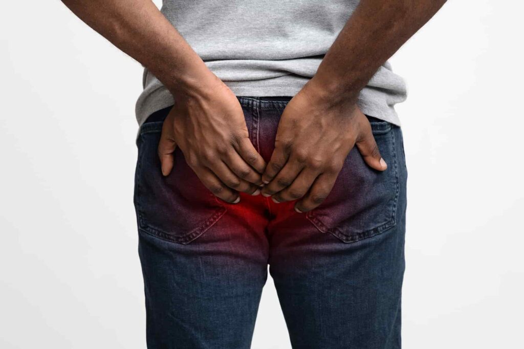 anal fissure treatment