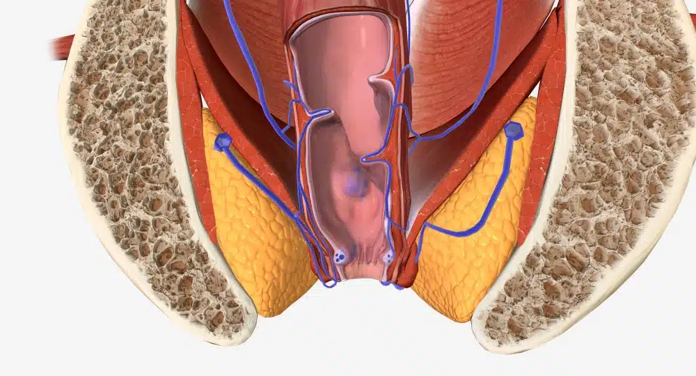 Anal Fistula in Dubai - German Medical Center
